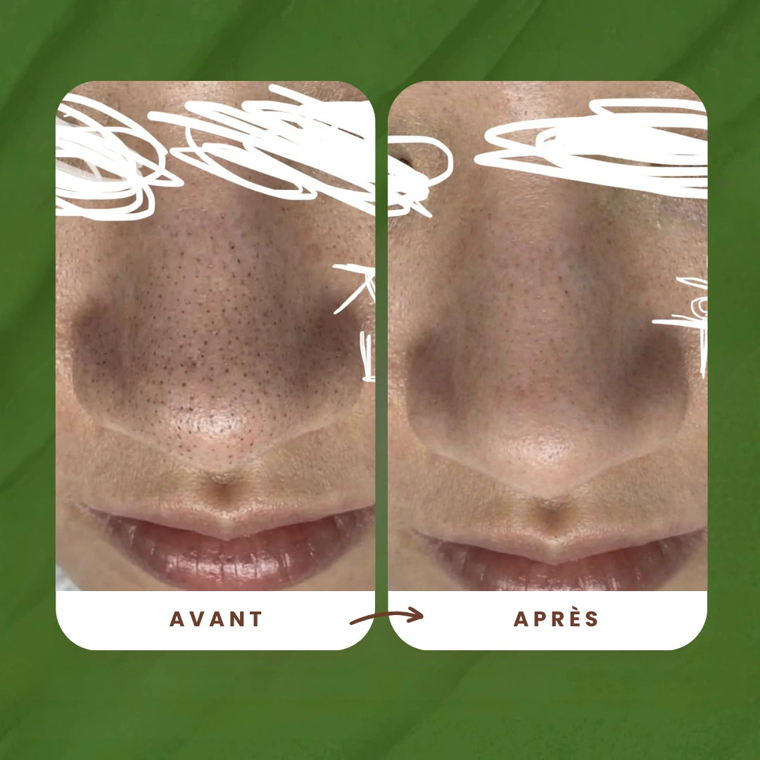 Masque à bulles au Basilic